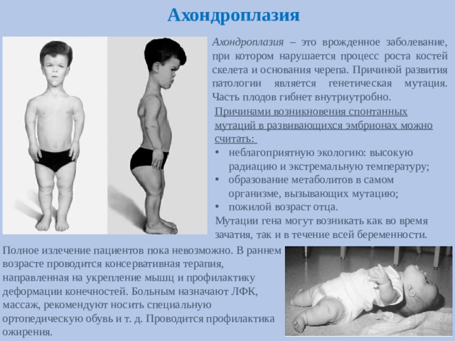 Ахондроплазия Ахондроплазия – это врожденное заболевание, при котором нарушается процесс роста костей скелета и основания черепа. Причиной развития патологии является генетическая мутация. Часть плодов гибнет внутриутробно. Причинами возникновения спонтанных мутаций в развивающихся эмбрионах можно считать:  неблагоприятную экологию: высокую радиацию и экстремальную температуру; образование метаболитов в самом организме, вызывающих мутацию; пожилой возраст отца. Мутации гена могут возникать как во время зачатия, так и в течение всей беременности. Полное излечение пациентов пока невозможно. В раннем возрасте проводится консервативная терапия, направленная на укрепление мышц и профилактику деформации конечностей. Больным назначают ЛФК, массаж, рекомендуют носить специальную ортопедическую обувь и т. д. Проводится профилактика ожирения.  