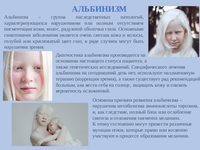 АЛЬБИНИЗМ Альбинизм – группа наследственных патологий, характеризующихся нарушениями или полным отсутствием пигментации кожи, волос, радужной оболочки глаза. Основными симптомами заболевания является очень светлая кожа и волосы, голубой или красноватый цвет глаз, в ряде случаев могут быть нарушения зрения.  Диагностика альбинизма производится на  основании настоящего статуса пациента, а  также генетических исследований. Специфического лечения альбинизма на сегодняшний день нет, используют паллиативную терапию (коррекция зрения), а также существует ряд рекомендаций больным, как вести себя на солнце, защищать кожу и снизить вероятность осложнений. Основная причина развития альбинизма –  нарушения метаболизма аминокислоты тирозина,  и, как следствие, полный блок или ослабление  синтеза и отложения пигмента меланина.  К этому состоянию могут привести различные  мутации генов, которые прямо или косвенно  участвуют в процессе образования меланина. 