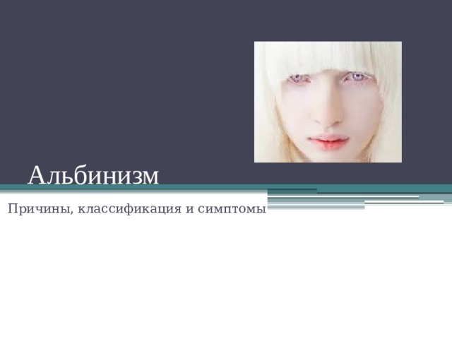 Альбинизм Причины, классификация и симптомы 