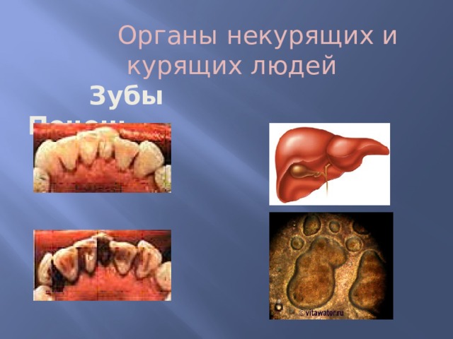  Органы некурящих и курящих людей  Зубы Печень   