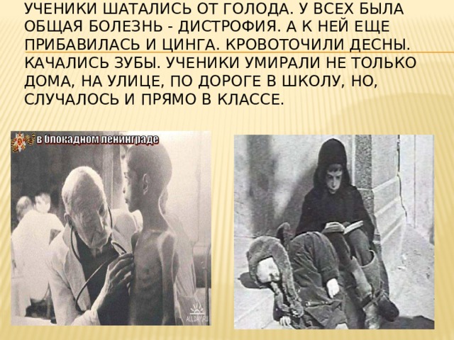 Ученики шатались от голода. У всех была общая болезнь - дистрофия. А к ней еще прибавилась и цинга. Кровоточили десны. Качались зубы. Ученики умирали не только дома, на улице, по дороге в школу, но, случалось и прямо в классе.   
