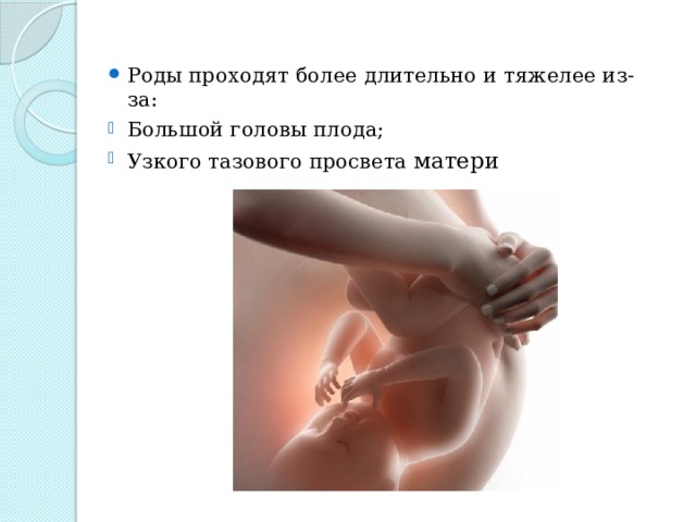 Роды проходят более длительно и тяжелее из-за: Большой головы плода; Узкого тазового просвета матери 