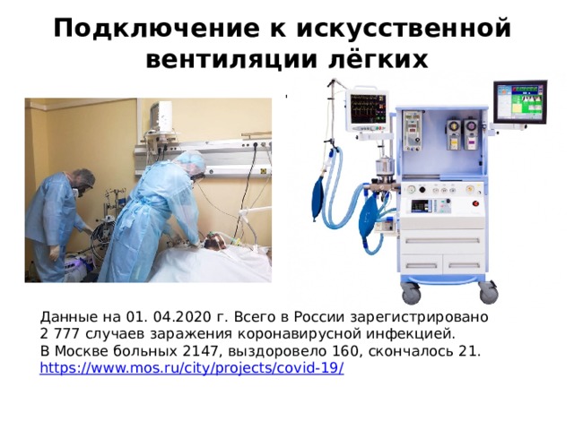 Подключение к искусственной  вентиляции лёгких  . Данные на 01. 04.2020 г. Всего в России зарегистрировано 2 777 случаев заражения коронавирусной инфекцией. В Москве больных 2147, выздоровело 160, скончалось 21. https ://www.mos.ru/city/projects/covid-19 / 