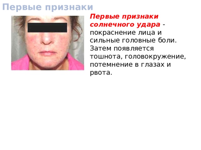 Первые признаки Первые признаки солнечного удара - покраснение лица и сильные головные боли. Затем появляется тошнота, головокружение, потемнение в глазах и рвота. 