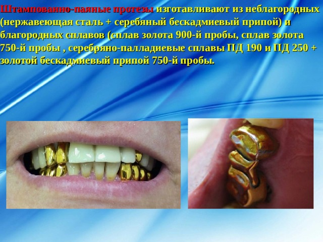 Штампованно-паяные протезы изготавливают из неблагородных (нержавеющая сталь + серебяный бескадмиевый припой) и благородных сплавов (сплав золота 900-й пробы, сплав золота 750-й пробы , серебряно-палладиевые сплавы ПД 190 и ПД 250 + золотой бескадмиевый припой 750-й пробы. 