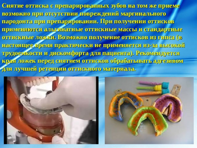 Снятие оттиска с препарированных зубов на том же приеме возможно при отсутствии повреждений маргинального пародонта при препарировании. При получении оттисков применяются альгинатные оттискные массы и стандартные оттискные ложки. Возможно получение оттисков из гипса (в настоящее время практически не применяется из-за высокой трудоемкости и дискомфорта для пациента). Рекомендуется края ложек перед снятием оттисков обрабатывать адгезивом для лучшей ретенции оттискного материала. 