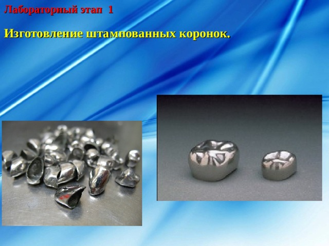 Лабораторный этап 1 Изготовление штампованных коронок. 