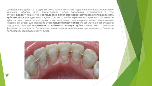 Шинирование зубов – это один из стоматологических методов лечения и восстановления здоровья зубного ряда. Шинирование зубов выполняют стоматологи в том случае,  когда  у пациентов  наблюдается патологическая шаткость  или подвижность зубного ряда  или единичных зубов. Для того, чтобы укрепить и сохранить собственные зубы, а, тем самым, предотвратить их выпадения, используется метод шинирования подвижных зубов. Шинирование зубов представляет собой  способ лечения заболеваний пародонта, дающий  возможность избежать потери зубов  пациентам с тяжелыми формами пародонтита. Проведение шинирования необходимо при наличии у больного патологической подвижности зубов.  