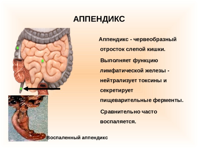 АППЕНДИКС  Аппендикс - червеобразный отросток слепой кишки.  Выполняет функцию лимфатической железы - нейтрализует токсины и секретирует пищеварительные ферменты.  Сравнительно часто воспаляется. Воспаленный аппендикс 