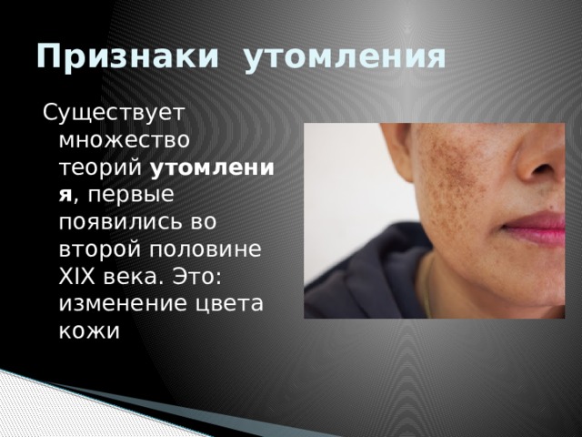 Признаки утомления Существует множество теорий  утомления , первые появились во второй половине XIX века. Это: изменение цвета кожи 