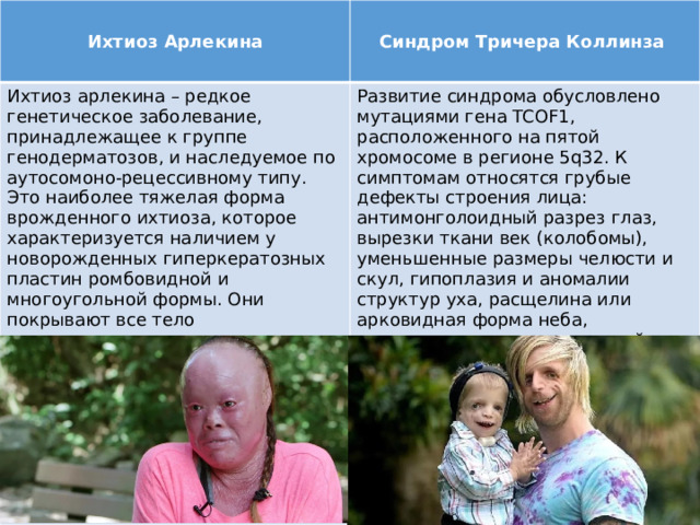 Ихтиоз Арлекина Синдром Тричера Коллинза Ихтиоз арлекина – редкое генетическое заболевание, принадлежащее к группе генодерматозов, и наследуемое по аутосомоно-рецессивному типу. Это наиболее тяжелая форма врожденного ихтиоза, которое характеризуется наличием у новорожденных гиперкератозных пластин ромбовидной и многоугольной формы. Они покрывают все тело геометрическим узором, напоминающим костюм арлекина (отсюда название болезни). Развитие синдрома обусловлено мутациями гена TCOF1, расположенного на пятой хромосоме в регионе 5q32. К симптомам относятся грубые дефекты строения лица: антимонголоидный разрез глаз, вырезки ткани век (колобомы), уменьшенные размеры челюсти и скул, гипоплазия и аномалии структур уха, расщелина или арковидная форма неба, увеличенные размеры ротовой щели и языка, слаборазвитые кости лица. 