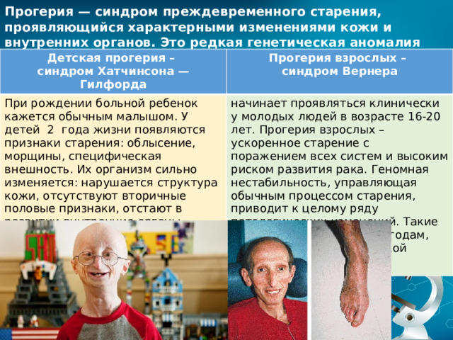 Прогерия — синдром преждевременного старения, проявляющийся характерными изменениями кожи и внутренних органов. Это редкая генетическая аномалия Детская прогерия – синдром Хатчинсона — Гилфорда Прогерия взрослых – При рождении больной ребенок кажется обычным малышом. У детей 2 года жизни появляются признаки старения: облысение, морщины, специфическая внешность. Их организм сильно изменяется: нарушается структура кожи, отсутствуют вторичные половые признаки, отстают в развитии внутренние органы. Восьмилетний ребенок с таким заболеванием выглядит и чувствует себя на 80 лет. синдром Вернера начинает проявляться клинически у молодых людей в возрасте 16-20 лет. Прогерия взрослых – ускоренное старение с поражением всех систем и высоким риском развития рака. Геномная нестабильность, управляющая обычным процессом старения, приводит к целому ряду патологических изменений. Такие больные умирают к 30-40 годам, имея все симптомы глубокой старости. 