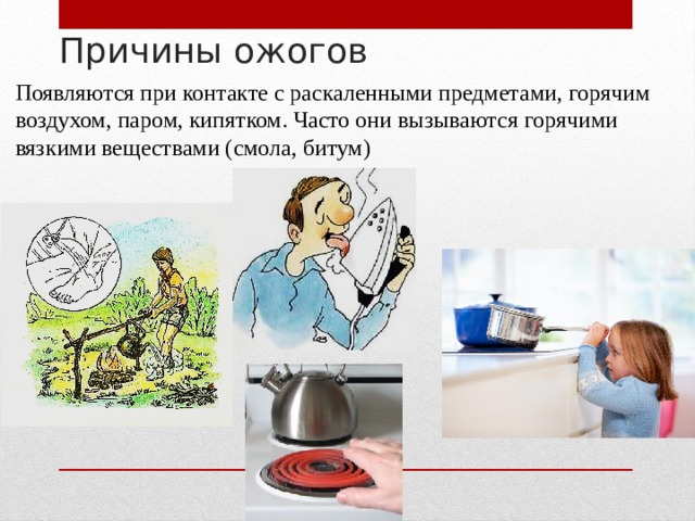 Причины ожогов Появляются при контакте с раскаленными предметами, горячим воздухом, паром, кипятком. Часто они вызываются горячими вязкими веществами (смола, битум) 