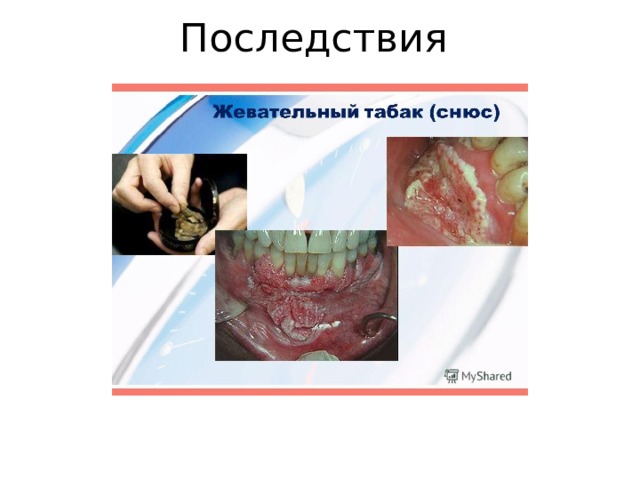 Последствия 