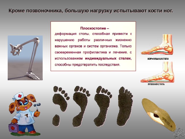 Кроме позвоночника, большую нагрузку испытывают кости ног. 