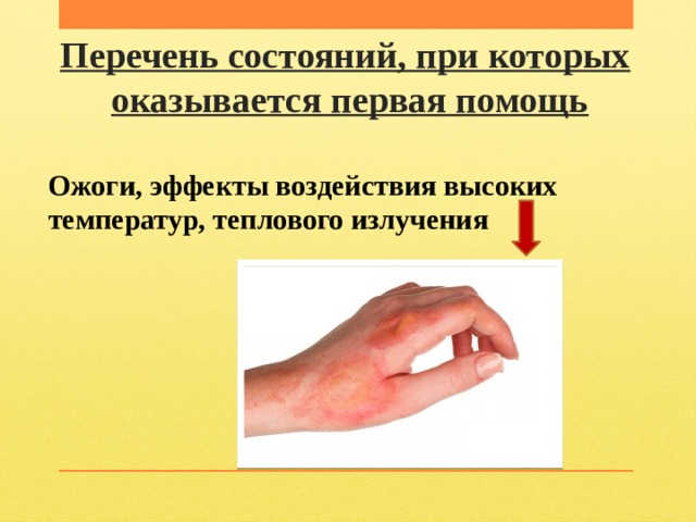 Перечень состояний, при которых   оказывается первая помощь Ожоги, эффекты воздействия высоких температур, теплового излучения 