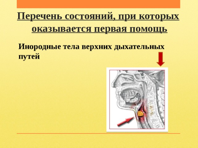 Перечень состояний, при которых   оказывается первая помощь Инородные тела верхних дыхательных путей 