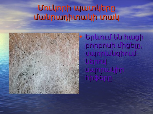 3.Աշխատանքի ընթացքը`  բամբակի օգնությամբ բորբոսից վերցնել մի կտոր, ունելիով այն տեղադրել առարկայակիր ապակու վրա և դիտել մանրադիտակով:   4.Գործնական աշխատանքի մեկնաբանություն   5. Գործնական աշխատանքի եզրակացություն   