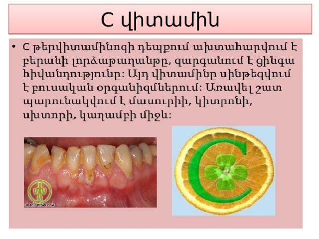 C վիտամին 