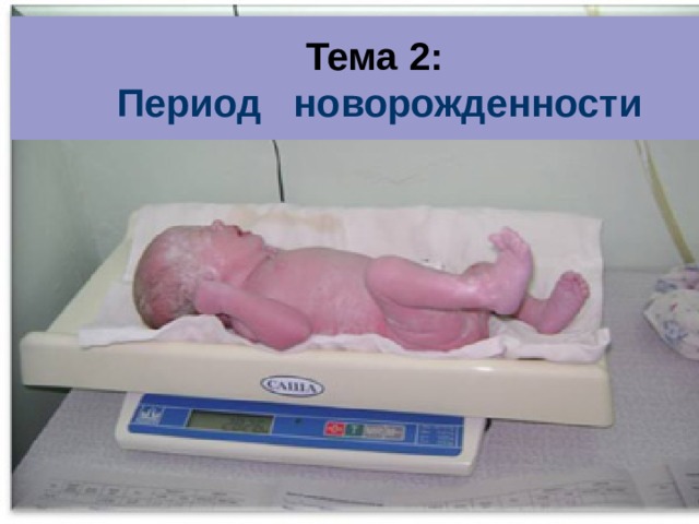Тема 2:  Период новорожденности 