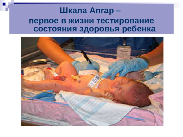 Шкала Апгар – первое в жизни тестирование состояния здоровья ребенка 