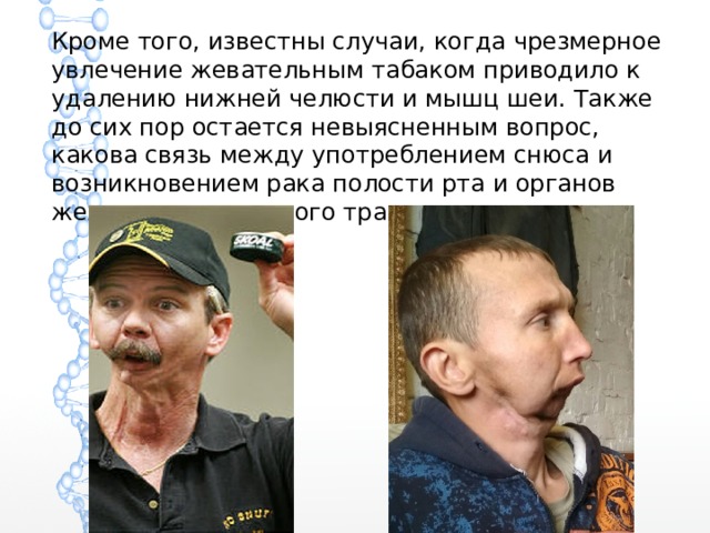 Кроме того, известны случаи, когда чрезмерное увлечение жевательным табаком приводило к удалению нижней челюсти и мышц шеи. Также до сих пор остается невыясненным вопрос, какова связь между употреблением снюса и возникновением рака полости рта и органов желудочно-кишечного тракта 