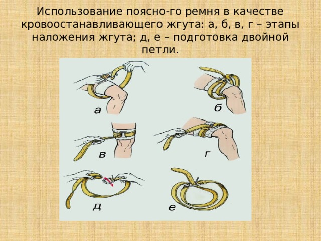 Использование поясно-го ремня в качестве кровоостанавливающего жгута: а, б, в, г – этапы наложения жгута; д, е – подготовка двойной петли. 