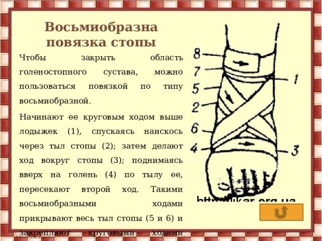 Восьмиобразна повязка стопы Чтобы закрыть область голеностопного сустава, можно пользоваться повязкой по типу восьмиобразной. Начинают ее круговым ходом выше лодыжек (1), спускаясь наискось через тыл стопы (2); затем делают ход вокруг стопы (3); поднимаясь вверх на голень (4) по тылу ее, пересекают второй ход. Такими восьмиобразными ходами прикрывают весь тыл стопы (5 и 6) и закрепляют круговыми ходами вокруг лодыжек (7 и 8). 