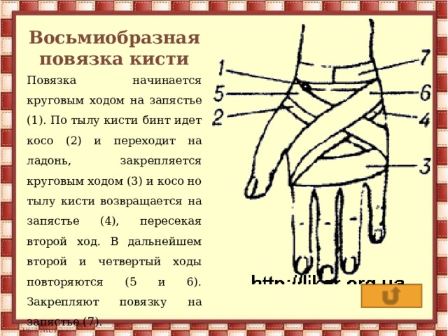 Восьмиобразная повязка кисти Повязка начинается круговым ходом на запястье (1). По тылу кисти бинт идет косо (2) и переходит на ладонь, закрепляется круговым ходом (3) и косо но тылу кисти возвращается на запястье (4), пересекая второй ход. В дальнейшем второй и четвертый ходы повторяются (5 и 6). Закрепляют повязку на запястье (7). 