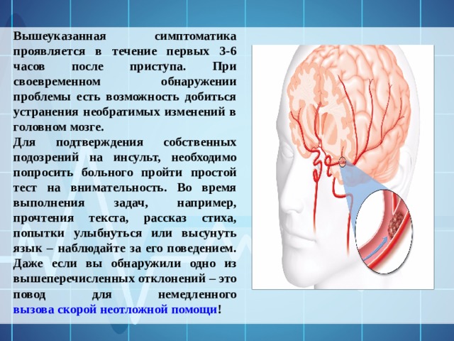 Вышеуказанная симптоматика проявляется в течение первых 3-6 часов после приступа. При своевременном обнаружении проблемы есть возможность добиться устранения необратимых изменений в головном мозге. Для подтверждения собственных подозрений на инсульт, необходимо попросить больного пройти простой тест на внимательность. Во время выполнения задач, например, прочтения текста, рассказ стиха, попытки улыбнуться или высунуть язык – наблюдайте за его поведением. Даже если вы обнаружили одно из вышеперечисленных отклонений – это повод для немедленного вызова скорой неотложной помощи ! 