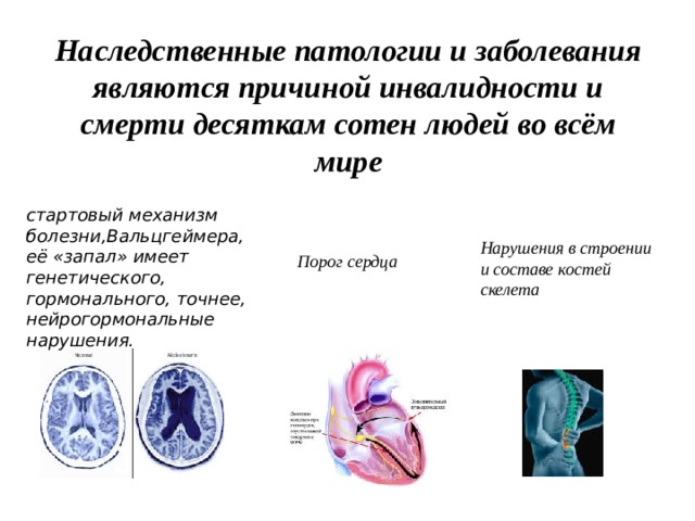 Наследственные патологии и заболевания являются причиной инвалидности и смерти десяткам сотен людей во всём мире стартовый механизм болезни,Вальцгеймера, её «запал» имеет генетического, гормонального, точнее, нейрогормональные нарушения. Нарушения в строении и составе костей скелета Порог сердца 