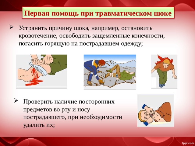 Первая помощь при травматическом шоке Устранить причину шока, например, остановить кровотечение, освободить защемленные конечности, погасить горящую на пострадавшем одежду; Проверить наличие посторонних предметов во рту и носу пострадавшего, при необходимости удалить их; 
