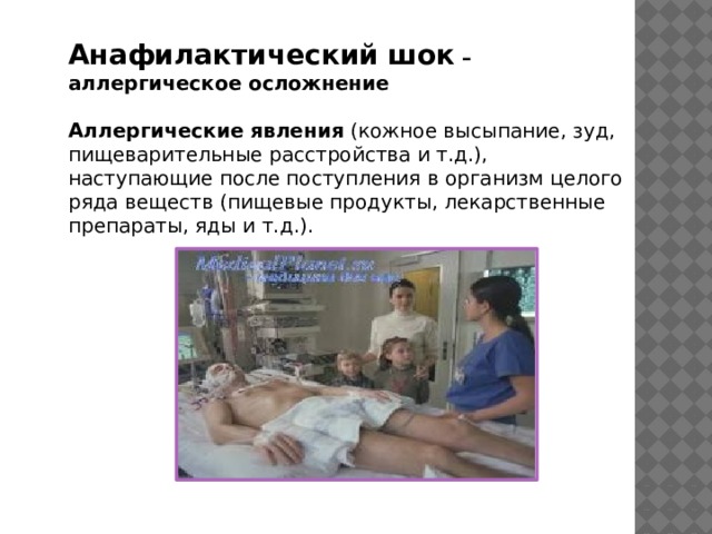 Анафилактический шок – аллергическое осложнение  Аллергические явления  (кожное высыпание, зуд, пищеварительные расстройства и т.д.), наступающие после поступления в организм целого ряда веществ (пищевые продукты, лекарственные препараты, яды и т.д.). 