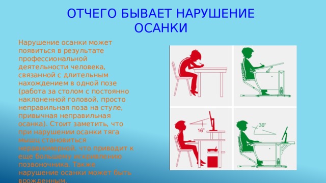 Отчего бывает нарушение осанки Нарушение осанки может появиться в результате профессиональной деятельности человека, связанной с длительным нахождением в одной позе (работа за столом с постоянно наклоненной головой, просто неправильная поза на стуле, привычная неправильная осанка). Стоит заметить, что при нарушении осанки тяга мышц становиться неравномерной, что приводит к еще большему искривлению позвоночника. Также нарушение осанки может быть врожденным. 