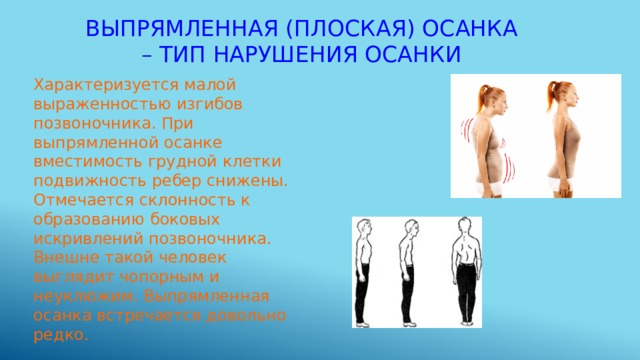 Выпрямленная (плоская) осанка – тип нарушения осанки Характеризуется малой выраженностью изгибов позвоночника. При выпрямленной осанке вместимость грудной клетки подвижность ребер снижены. Отмечается склонность к образованию боковых искривлений позвоночника. Внешне такой человек выглядит чопорным и неуклюжим. Выпрямленная осанка встречается довольно редко. 