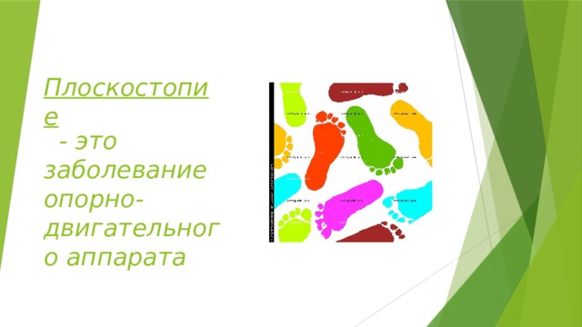 Плоскостопие   - это заболевание опорно-двигательного аппарата 