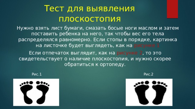 Тест для выявления плоскостопия Нужно взять лист бумаги, смазать босые ноги маслом и затем поставить ребенка на него, так чтобы вес его тела распределялся равномерно. Если стопы в порядке, картинка на листочке будет выглядеть, как на рисунке 1 Если отпечаток выглядит, как на рисунке 2 , то это свидетельствует о наличие плоскостопия, и нужно скорее обратиться к ортопеду. Рис.1 Рис.2 