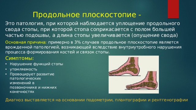 Продольное плоскостопие - Это патология, при которой наблюдается уплощение продольного свода стопы, при которой стопа соприкасается с полом большей частью подошвы, а длина стопы увеличивается (опущение свода) Основная причина: примерно в 3% случаев продольное плоскостопие является врожденной патологией, возникающей вследствие внутриутробного нарушения процесса формирования костей и связок стопы. Симптомы: Нарушение функций стопы утомляемость Провоцирует развитие патологических изменений в позвоночнике и нижних конечностях Диагноз выставляется на основании подометрии, плантографии и рентгенографии 