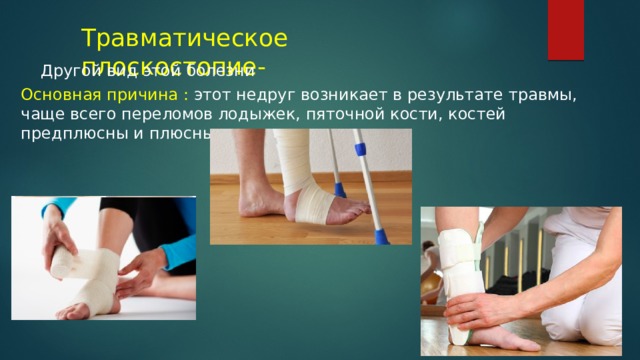 Травматическое плоскостопие- Другой вид этой болезни Основная причина : этот недруг возникает в результате травмы, чаще всего переломов лодыжек, пяточной кости, костей предплюсны и плюсны. 