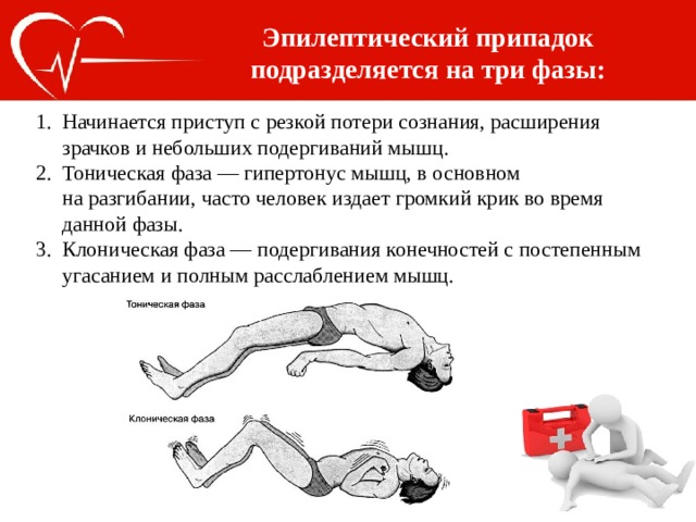 Эпилептический припадок подразделяется на три фазы: Начинается приступ с резкой потери сознания, расширения зрачков и небольших подергиваний мышц. Тоническая фаза — гипертонус мышц, в основном на разгибании, часто человек издает громкий крик во время данной фазы. Клоническая фаза — подергивания конечностей с постепенным угасанием и полным расслаблением мышц. 
