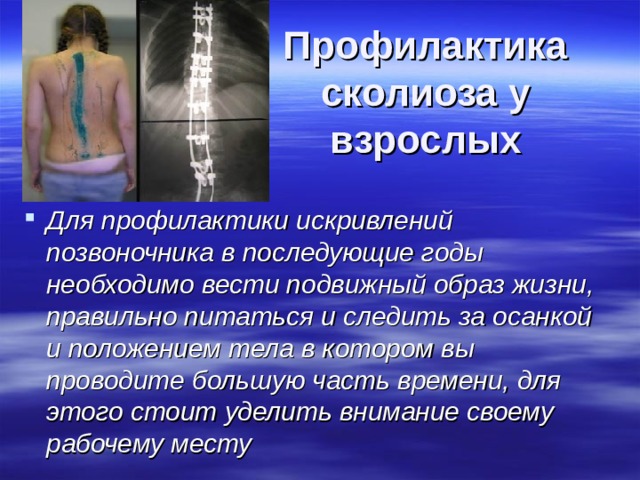 Профилактика сколиоза у взрослых Для профилактики искривлений позвоночника в последующие годы необходимо вести подвижный образ жизни, правильно питаться и следить за осанкой и положением тела в котором вы проводите большую часть времени, для этого стоит уделить внимание своему рабочему месту 