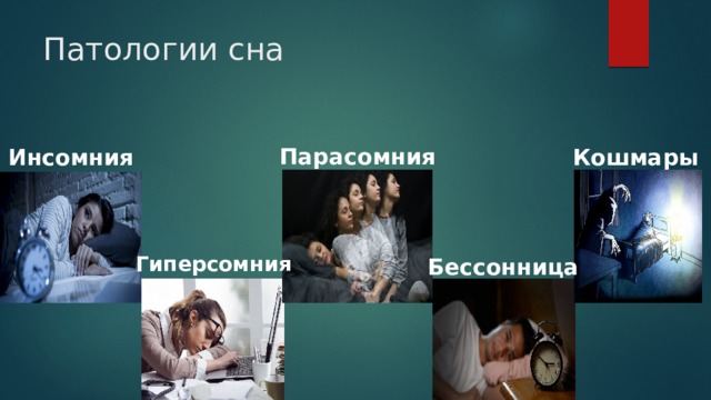 Патологии сна Парасомния Инсомния Кошмары Гиперсомния Бессонница 