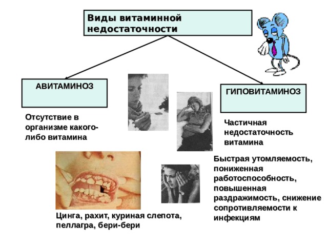 Виды витаминной недостаточности АВИТАМИНОЗ  ГИПОВИТАМИНОЗ  Отсутствие в организме какого-либо витамина Частичная недостаточность витамина Быстрая утомляемость, пониженная работоспособность, повышенная раздражимость, снижение сопротивляемости к инфекциям Цинга, рахит, куриная слепота, пеллагра, бери-бери 