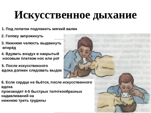 Искусственное дыхание 1. Под лопатки подложить мягкий валик 2. Голову запрокинуть  3. Нижнюю челюсть выдвинуть  вперёд 4. Вдувать воздух в накрытый  носовым платком нос или рот  5. После искусственного вдоха должен следовать выдох   6. Если сердце не бьётся, после искусственного вдоха производят 4-5 быстрых толчткообразных надавливаний на нижнюю треть грудины  