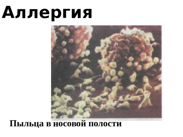 Аллергия Пыльца в носовой полости 