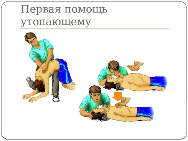 Первая помощь утопающему 