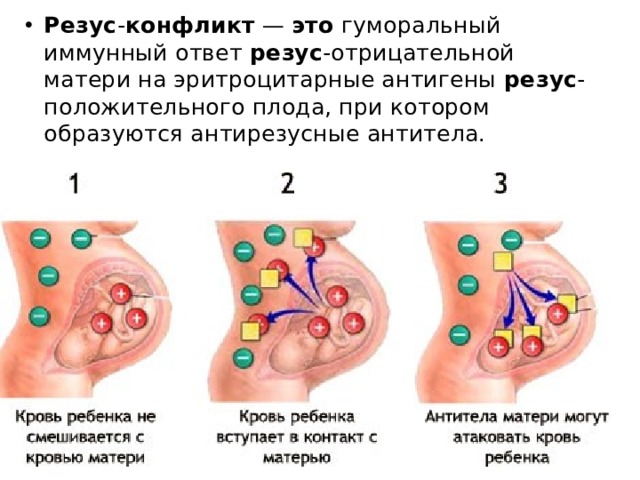 Резус - конфликт  —  это  гуморальный иммунный ответ  резус -отрицательной матери на эритроцитарные антигены  резус -положительного плода, при котором образуются антирезусные антитела. 