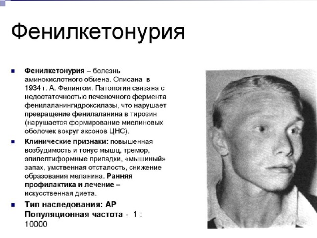 Фенилкетонурия 
