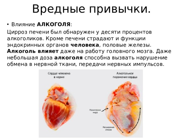 Вредные привычки. Влияние АЛКОГОЛЯ : Цирроз печени был обнаружен у десяти процентов алкоголиков. Кроме печени страдают и функции эндокринных органов  человека , половые железы. Алкоголь влияет  даже на работу головного мозга. Даже небольшая доза алкоголя  способна вызвать нарушение обмена в нервной ткани, передачи нервных импульсов. 