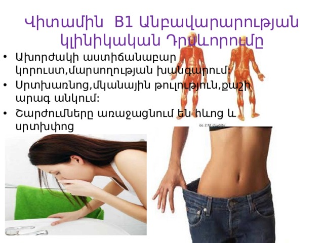 Վիտամին B1 Անբավարարության կլինիկական Դրսևորումը Ախորժակի աստիճանաբար կորուստ,մարսողության խանգարում: Սրտխառնոց,մկանային թուլություն,քաշի արագ անկում: Շարժումները առաջացնում են հևոց և սրտխփոց 